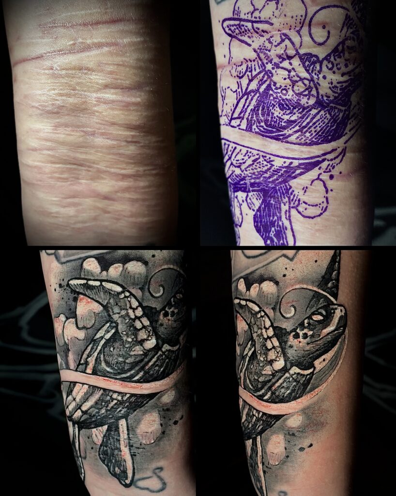 Vorher / Nachher Bilder Narben Cover-Up Narben überdecken