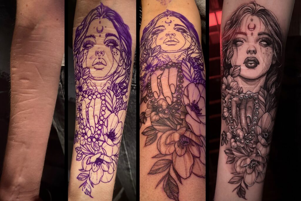 SCAR Cover-Up / Narben übertätowieren im Woodpecker Tattoo Studio in Innsbruck